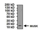 MUSK Antibody in Western Blot (WB)