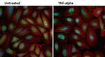 NFkB p65 Antibody in Immunocytochemistry (ICC/IF)