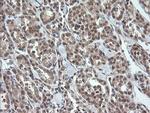 OTUB1 Antibody in Immunohistochemistry (Paraffin) (IHC (P))