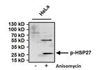 Phospho-HSP27 (Ser15) Antibody