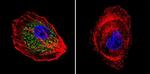 Cdc42 Antibody in Immunocytochemistry (ICC/IF)