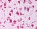 LRRK2 Antibody in Immunohistochemistry (Paraffin) (IHC (P))