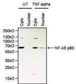 NFkB p65 Antibody