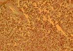 CCR4 Antibody in Immunohistochemistry (IHC)