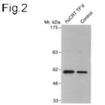 Calreticulin Antibody in Western Blot (WB)