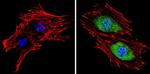 PSMB5 Antibody in Immunocytochemistry (ICC/IF)