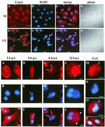 Cyclophilin A Antibody in Immunocytochemistry (ICC/IF)