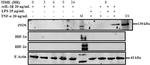 iNOS Antibody in Western Blot (WB)