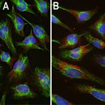 Ubiquitin Antibody in Immunocytochemistry (ICC/IF)