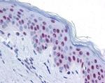 MRE11 Antibody in Immunohistochemistry (Paraffin) (IHC (P))