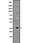 CD63 Antibody in Western Blot (WB)