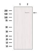 CD206 Antibody in Western Blot (WB)