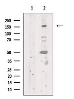 FANCD2 Antibody in Western Blot (WB)