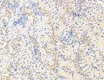 NOD2 Antibody in Immunohistochemistry (Paraffin) (IHC (P))