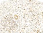 NOD2 Antibody in Immunohistochemistry (Paraffin) (IHC (P))