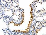 NOD2 Antibody in Immunohistochemistry (Paraffin) (IHC (P))