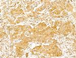 NOD2 Antibody in Immunohistochemistry (Paraffin) (IHC (P))