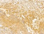 NOD2 Antibody in Immunohistochemistry (Paraffin) (IHC (P))