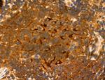 NOD2 Antibody in Immunohistochemistry (Paraffin) (IHC (P))