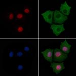 Phospho-KLF4 (Ser254) Antibody in Immunocytochemistry (ICC/IF)