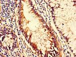 CD151 Antibody in Immunohistochemistry (Paraffin) (IHC (P))