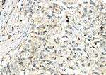 CTLA-4 Antibody in Immunohistochemistry (Paraffin) (IHC (P))