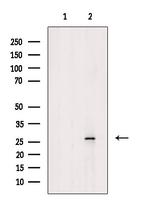 Phospho-Caveolin 2 (Ser36) Antibody in Western Blot (WB)