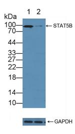 STAT5 beta Antibody in Western Blot (WB)