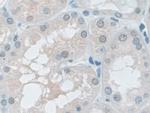 VCP Antibody in Immunohistochemistry (Paraffin) (IHC (P))