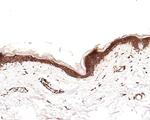 CD116 Antibody in Immunohistochemistry (Paraffin) (IHC (P))