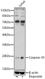 Caspase 10 Antibody in Western Blot (WB)