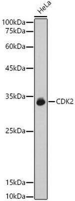 CDK2 Antibody in Western Blot (WB)