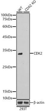 CDK2 Antibody in Western Blot (WB)