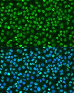 Histone H2A.X Antibody in Immunocytochemistry (ICC/IF)