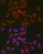 BOK Antibody in Immunocytochemistry (ICC/IF)