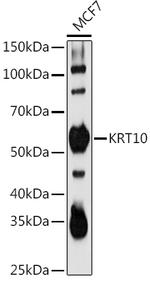 Cytokeratin 10 Antibody in Western Blot (WB)