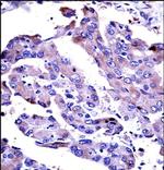 AKT2 Antibody in Immunohistochemistry (Paraffin) (IHC (P))