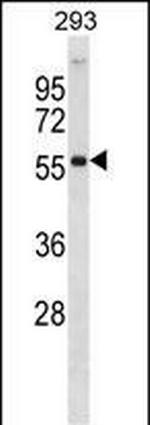 AKT2 Antibody in Western Blot (WB)