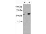 IL13RA1 Antibody in Western Blot (WB)