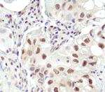 Ubiquitin Antibody in Immunohistochemistry (IHC)