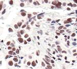 H3K4me3 Antibody in Immunohistochemistry (Paraffin) (IHC (P))