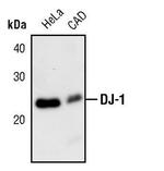 DJ-1 Antibody in Western Blot (WB)