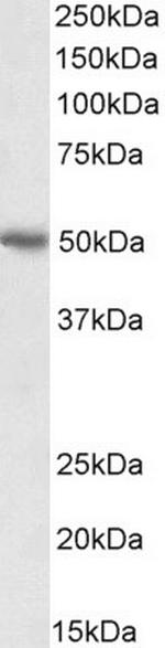 PD-L1 Antibody in Western Blot (WB)