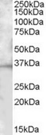 BTLA Antibody in Western Blot (WB)