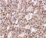 TLR2 Antibody in Immunohistochemistry (IHC)