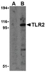 TLR2 Antibody in Western Blot (WB)