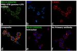 PD-L1 Antibody