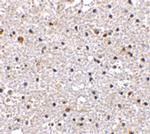 PD-1 Antibody in Immunohistochemistry (Paraffin) (IHC (P))