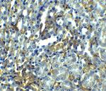 RIP1 Antibody in Immunohistochemistry (IHC)