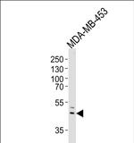 IL5RA Antibody in Western Blot (WB)